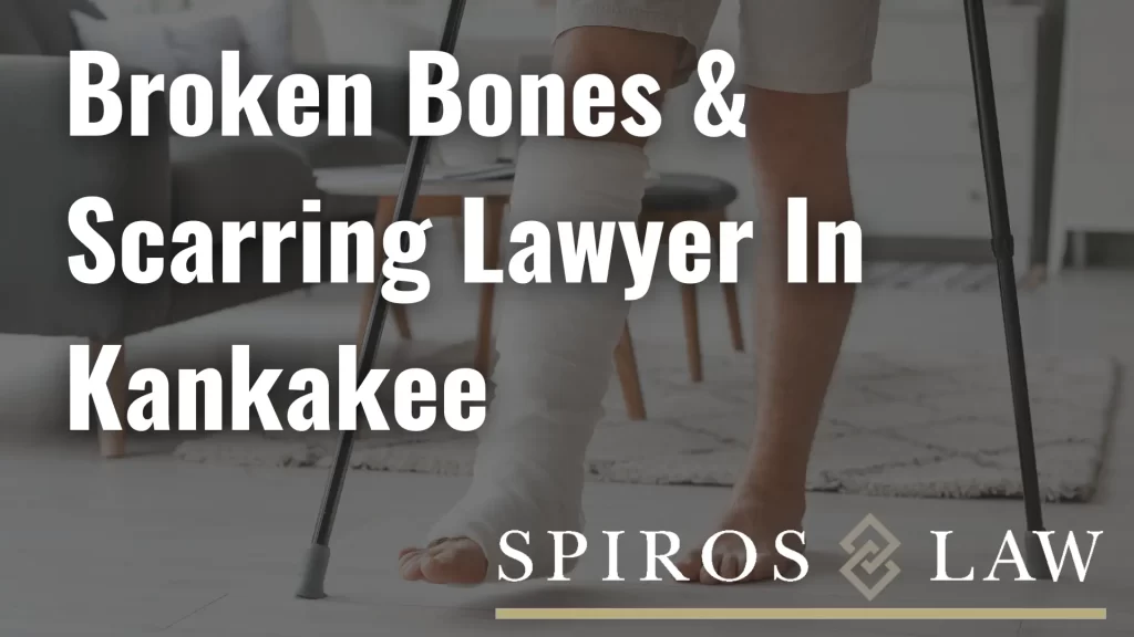 Broken Bones & Scarring Lawyer In Kankakee