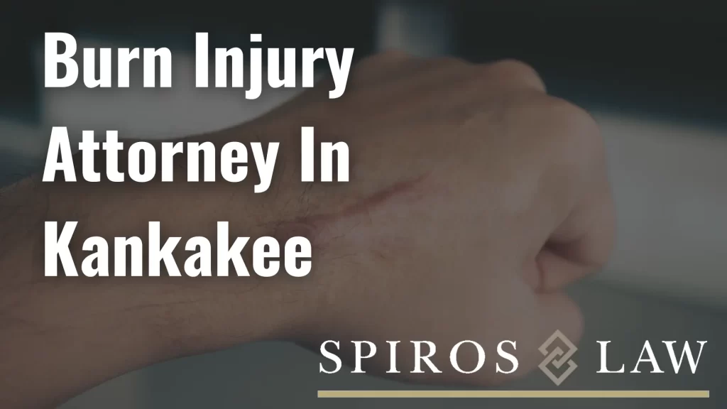 Los Angeles Amputation Attorney thumbnail