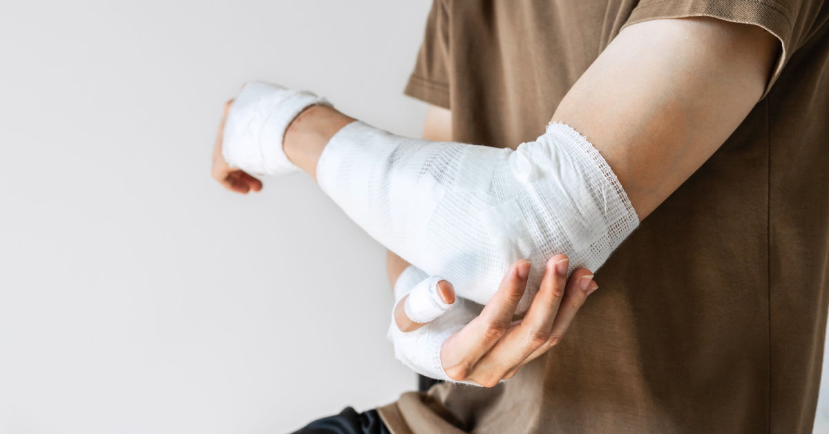 Illinois Burn Injury Lawyer Near Me | Free Consultation | Spiros Law